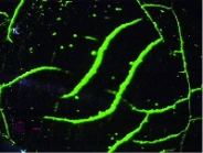 Dark field NDT imaging showing vivid fluorescent green luminous traces marking linear surface cracks on metal material under ultraviolet excitation
